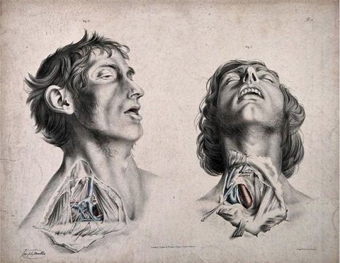 Illustration. Two men are shown from the shoulders up, each with their throat and neck dissected. Both are clean shaven with mutton chops, and their mouths are open. The man on our left is shown almost in profile facing our right, his eyes half open and his face slack. We look onto the underside of the other man’s chin as his head falls far back. His eyes are closed.