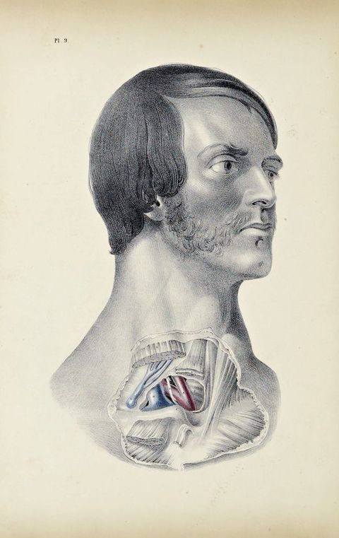 Illustration. Shown from the clavicle up, a man’s lower neck and upper chest are dissected. His pale-skinned face angles to our right. He has smooth, dark hair and mutton chops connect with a moustache. His eyes are open and his lips closed. Veins are painted blue and arteries red in the dissected area.