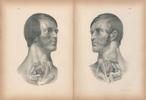 Illustration. On facing pages, the skin over the throat and upper chest of two pale-skinned men has been removed and some vessels painted red and blue. They have similar facial features, including clefts in their chins. They both have mutton chops, but only the mutton chops on the man to our left connect to a moustache.